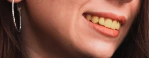 Dents jaune et vape, est-ce lié ? Que faire ?